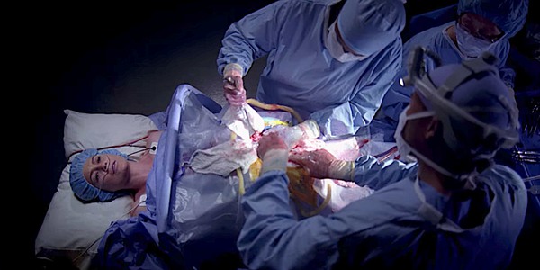 Anatomia Greya Meredith instruuje chirurga, jak naprawić śledzionę